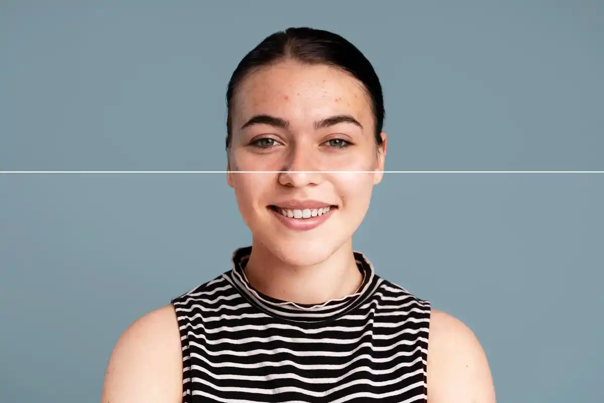 korean glass skin dutch woman before after